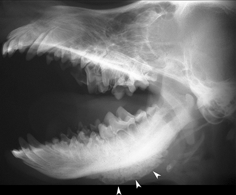 Craniomandibuläre Osteopathie