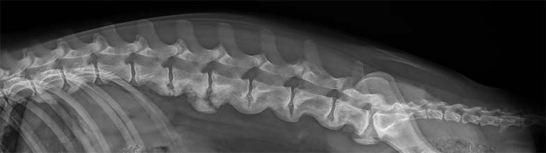 Diffuse idiopathische skelettale Hyperostose (DISH)